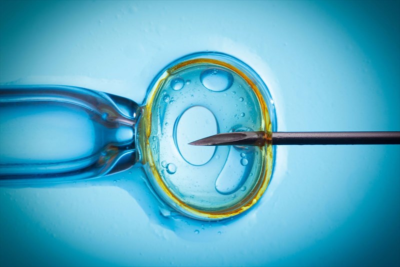 In-vitro Fertilisation (IVF)